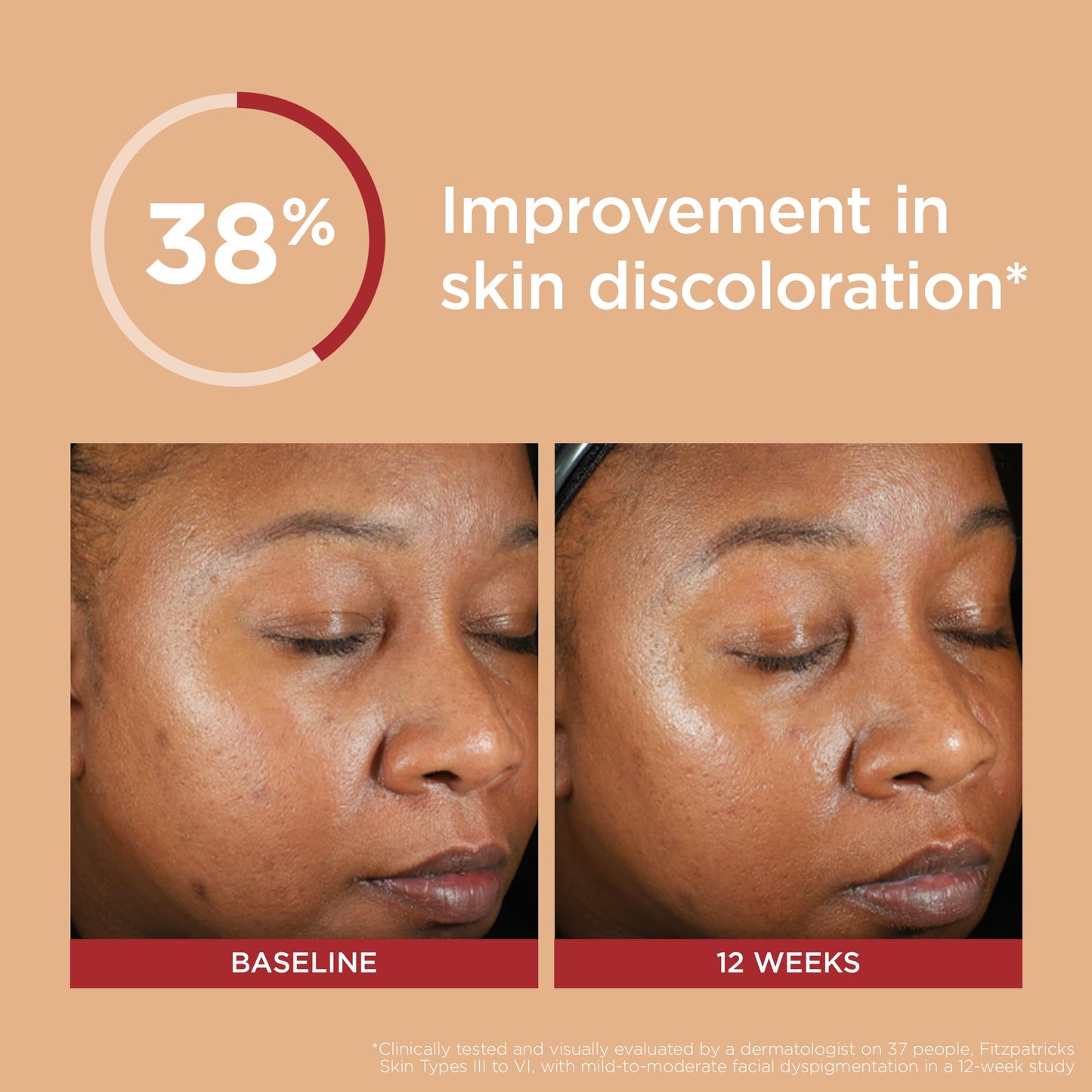 Elta MD UV Clear - Deep tint