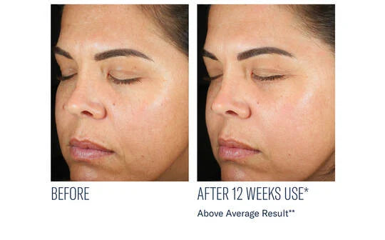 SkinBetter Even Intensive