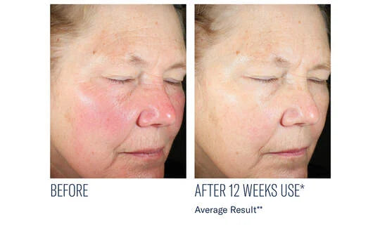 SkinBetter Even Intensive