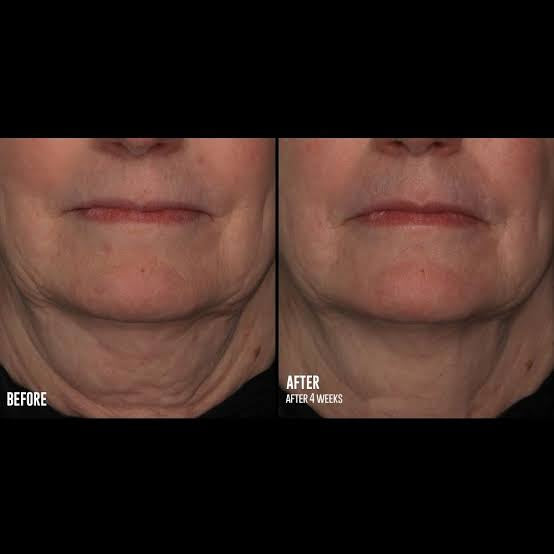 SkinBetter Interfuse Face and Neck Treatment Cream