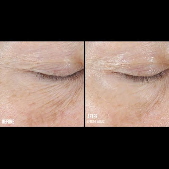 SkinBetter Interfuse Eye Cream