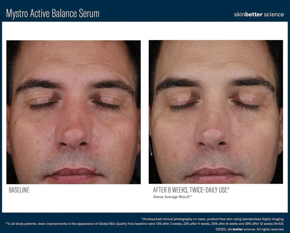 SkinBetter Mystro Active Balance Serum